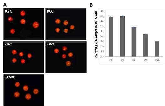 Distribution of telomeres on lymphocyte by FISH using telomeric DNA probe. The telomeric DNA is indicated by green, yellow spots against the genomic DNA (red background). The relative amount of telomeric DNA was detemined to be KYC:1.87±0.05, KCC:1.86±0.15, KBC:1.74±0.11, KWC:1.67±0.10, and KCWC:1.60±0.05