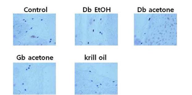 Liver histology of PBS control, ethanol extract or acetone extract from dung beetle, acetone extract from Gryllus bimaculatus, krill oil by toluidine blue staining