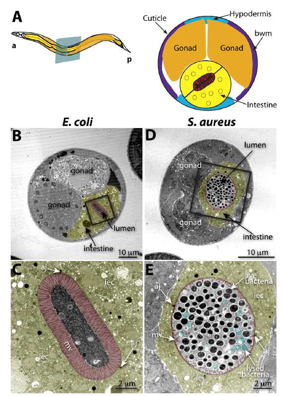 병원성 미생물 감염시 C. elegans의 장관변화의 전자현미경 사진