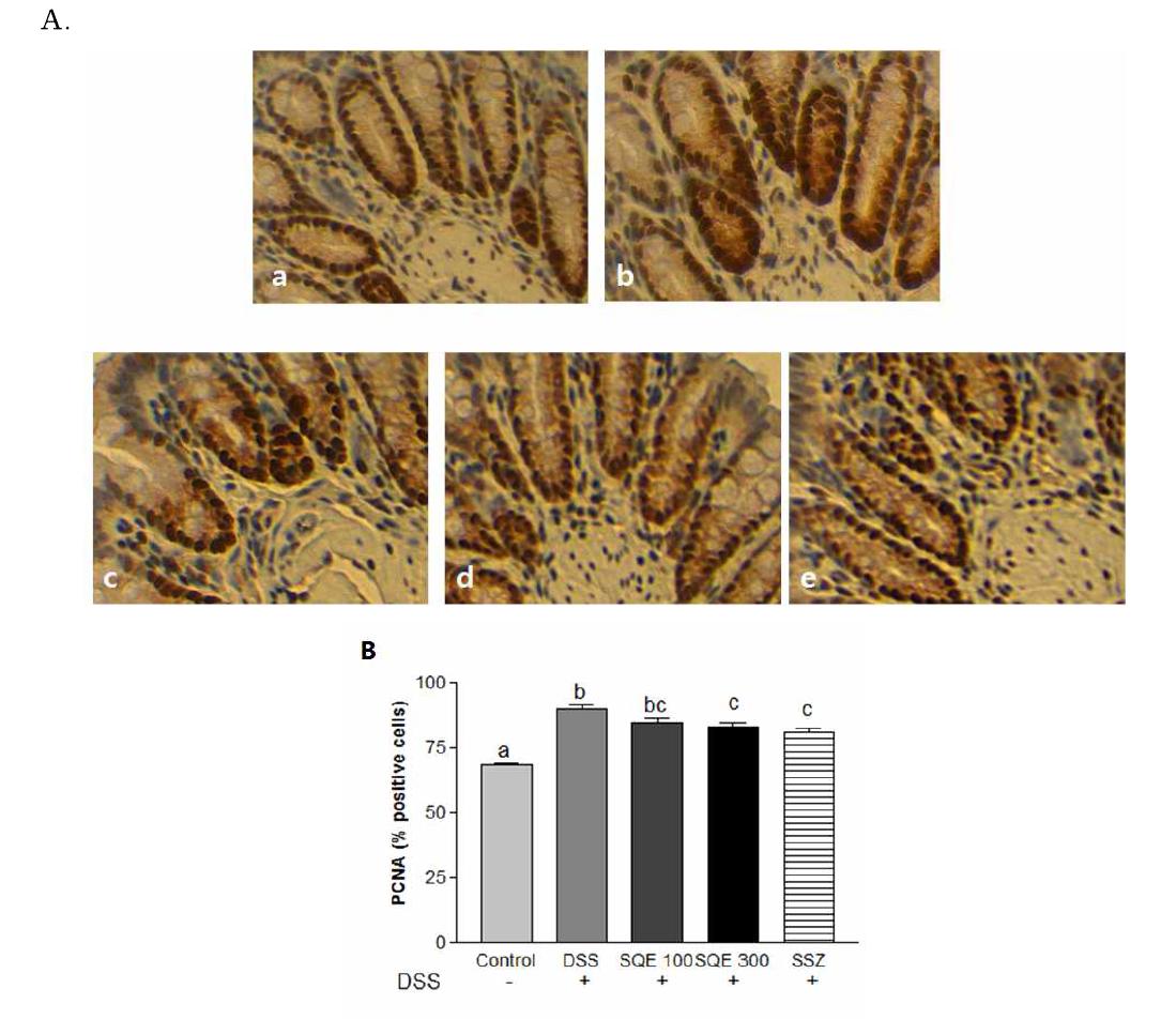 Effect of SQE on PCNA expression by immuno-histochemistry method in the animal model of DSS-induced colitis