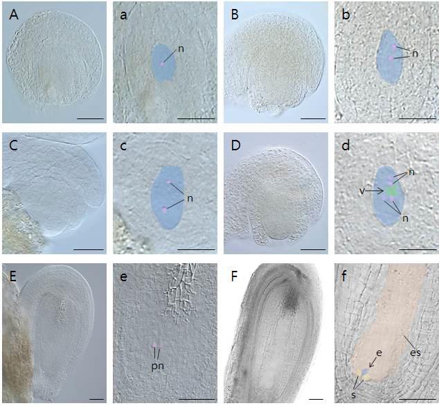 DIC(Differential Interferance Contrast) 현미경에서 관찰한 ‘Tamnara’의 ovule 내부 대포자 발달 사진