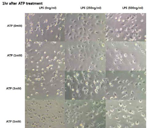 Effect of different ATP and LPS concentration on the on the morphology of THP-1 cells.