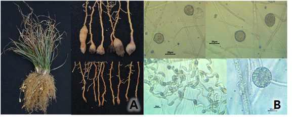 맥문동 뿌리썩음병(가칭)의 병징(A)과 병원균 Pythium sylvaticum 의 유주자낭(B).