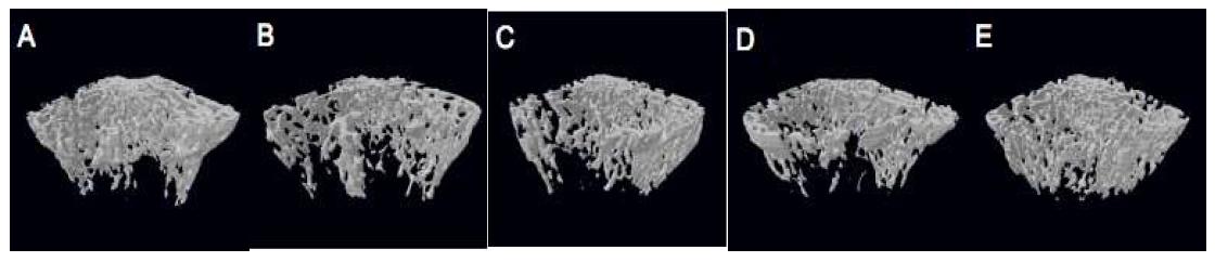 Representative µCT-images of the trabecular bone