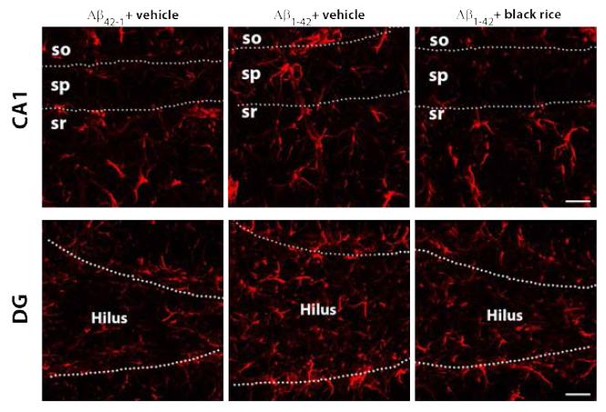 알츠하이머 치매 동물모델에서 흑미 추출물에 의한 별아교세포 활성 변화 관찰을 위한 대조군(Aβ42–1+vehicle, n=8), 치매모델대조군(Aβ1–42+vehicle, n=12), 그리고 치매모델흑미군(Aβ1–42+black rice, n=10)의 CA1 영역과 DG 영역의 GFAP 항체를 이용한 형광염색사진(scale bar=20 um).