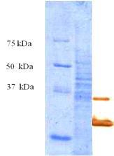 Reacitivty of ST1D2 against surface proteins of different bacteria in WB