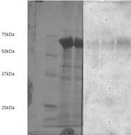 Reactivity of ST8C7 against surface proteins of different bacteria in WB