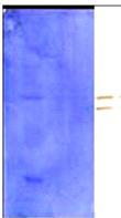 Reactivity of LM1E5 against surface proteins of different bacteria in WB.