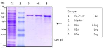 SDS PAGE analysis of B. cereus ATCC 14579 cell wall fraction