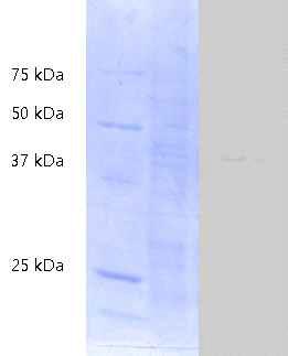 Reactivity of BC4B7 against surface proteins of different bacteria in WB.