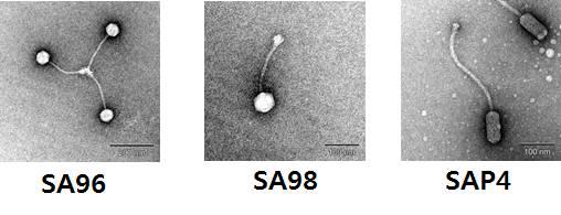 S. aureus를 감염시키는 bacteriophage의 TEM 이미지