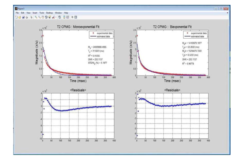 T2 analysis window.