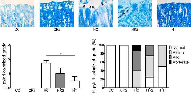 1`와 4`FRVE에 의한 H. pylori colonized grade