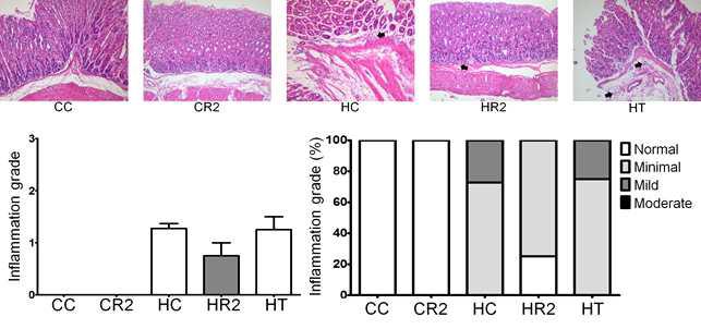 4`FRVE에 의한 inflammation grade