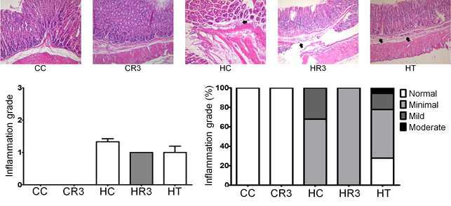 4`FRVE에 의한 inflammation grade