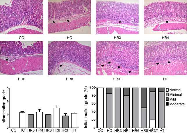 5`FRVE에 의한 inflammation grade