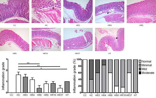 5`FRVE에 의한 inflammation grade