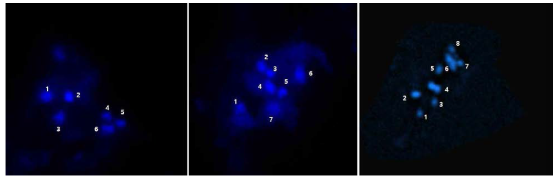 만가닥 버섯의 metaphase I stage cell(X2500).