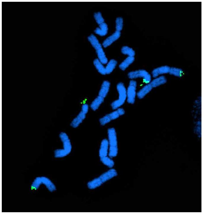 Contig 내에서 선발된 10번째 marker는 ribosomal DNA(green fluorescence)의 위치와 동일하다.