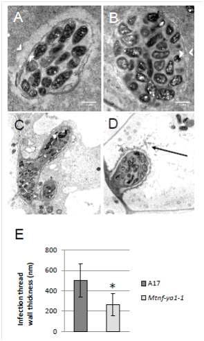 Analysis of infection thread ultrastructure using Transmission Electron Microscopy