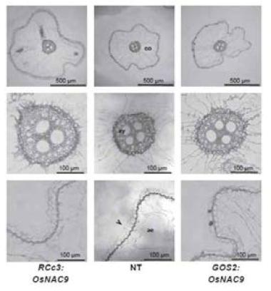 OsNAC9 형질전환체의 뿌리 현미경 사진