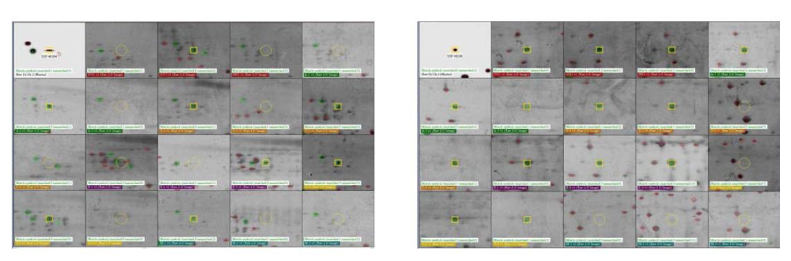 Analyse of density for two kind of proteins appeared at high level in semen ejaculated