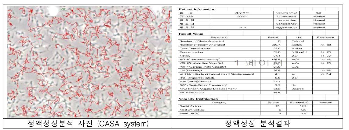 CASA system에 의한 정액 성상분석 사진 및 분석결과