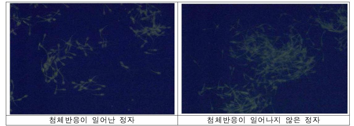 첨체반응이 일어난 정자와 일어나지 않은 정자