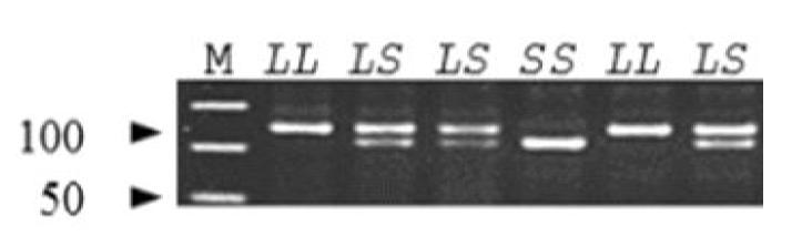 Analysis of different GALM genetypes