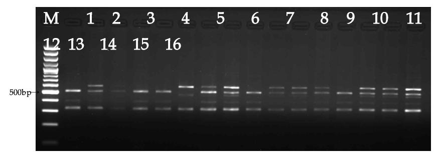 Marker protein 1 exon 34 g.51C>T RsaI PCR-RFLP M, DNA size marker