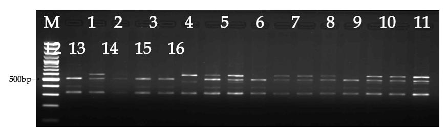 MYH4 exon 34 g.51C>T에 대한 RsaI PCR-RFLP 시험 결과. M, DNA size marker