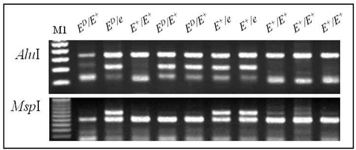 Different MC1R genetypes by PCR-RFLP