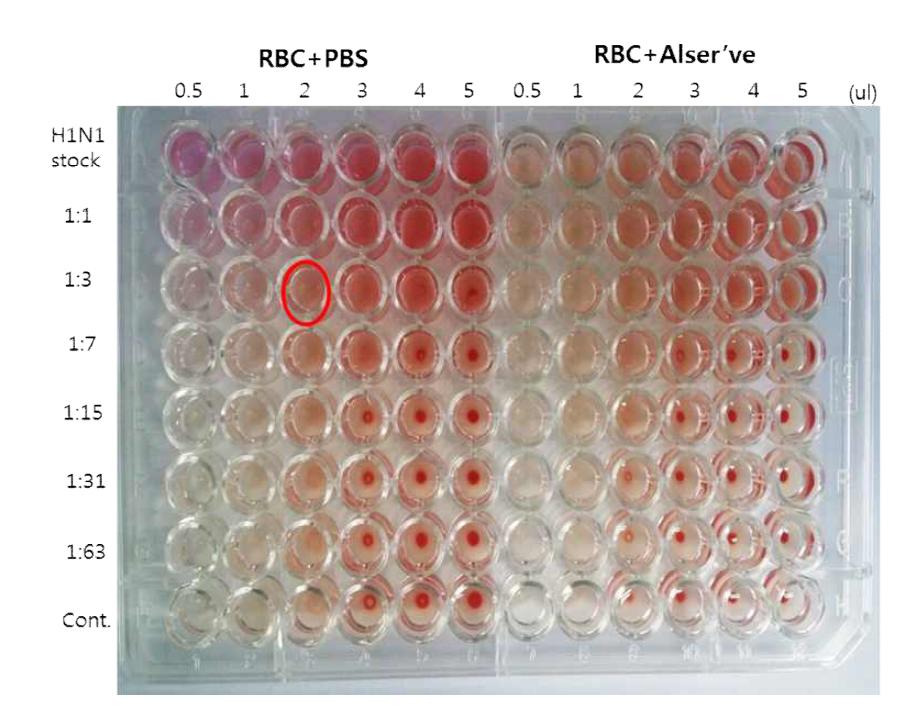 인플루엔자 바이러스 A (H1N1)와 RBC의 희석조건확립