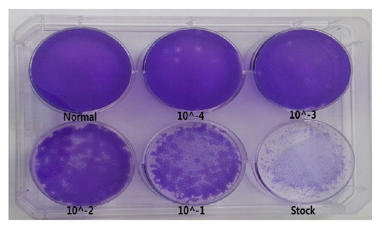 인플루엔자 바이러스에 대한 plaque assay