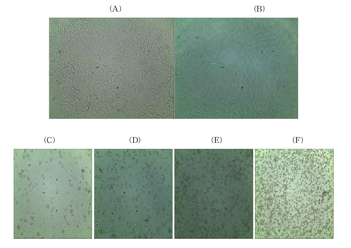 Micrographs of MDCK cells infected with influenza virus type A(H1N1) (X 200).