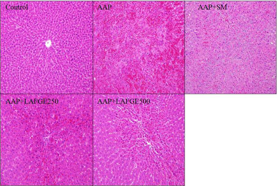 Histological analysis of acetaminophen-intoxicated rat livers(x200).