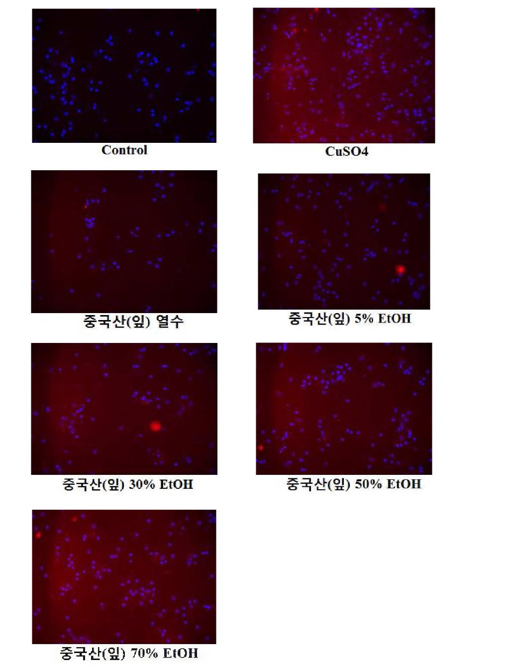 inhibitory effects of extracts from Hippophae rhamnoides against CuS〇4-induced HO-1express on primary cortex neuron cells (China, leaves).