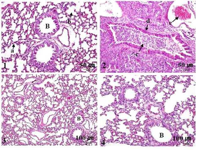 Histological observations of lungs from the control group mice (1) and the immunised group mice (2) at day 3 post-immunisation, the control group mice (3) and the immunised group mice (4) at week 4 post-immunisation