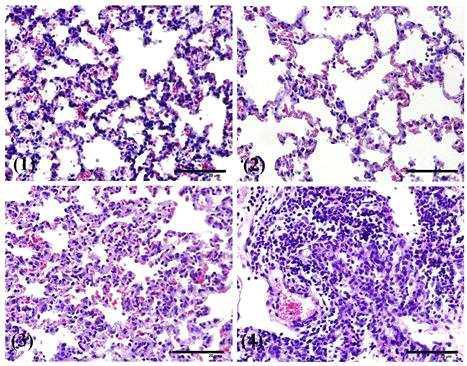 Representative histology of infected tissues from immunized andnon-immunized mice after a wild-type Pasteurella multocida challenge