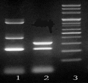 Gel electrophoresis of multiplex PCR assay products for two B. cereus group members).