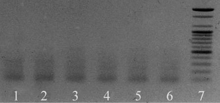 Gel electrophoresis of multiplex PCR assay products for non-target strains.