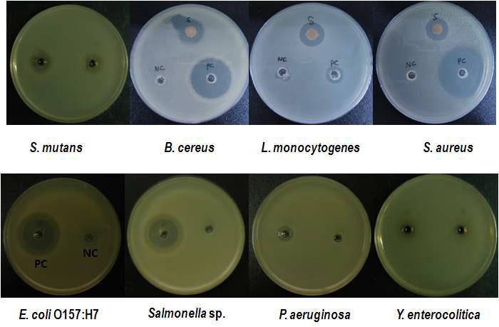 Antimicrobiao activity by Agar well diffusion assay.