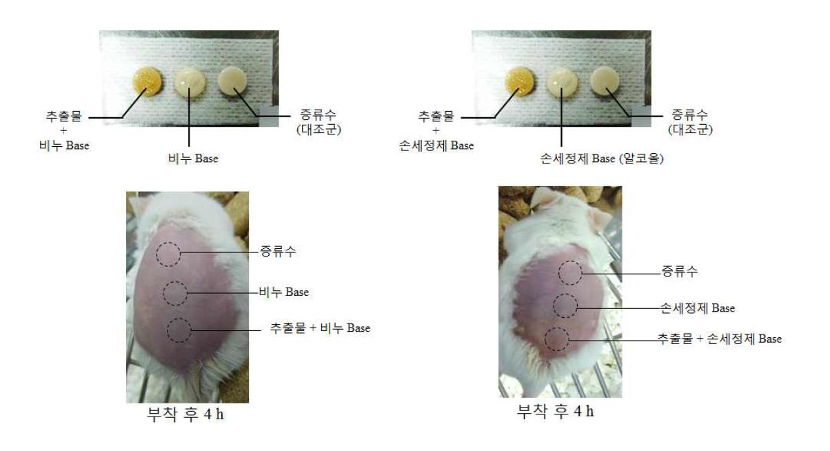 Skin Irritation studies on final antibacterial compound.