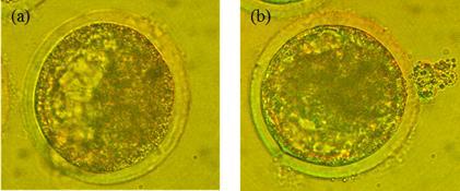 각 배양액에서 배양한 체세포에 의한 이종간복제 배반포 (a)RCME-P배지에서 배양한 세포 유래의 배반포, (b) DMEM배지에서 배양한 세포 유래의 배반포 (200배 확대사진).