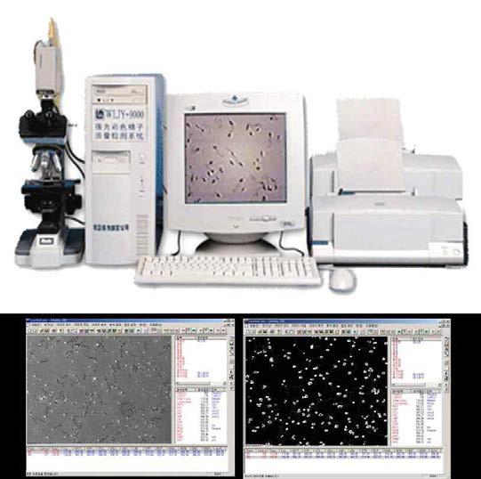 정자 이미지 분석 시스템 (CASA)