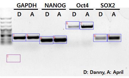 대니와 April의 유전자 발현 비교 결과