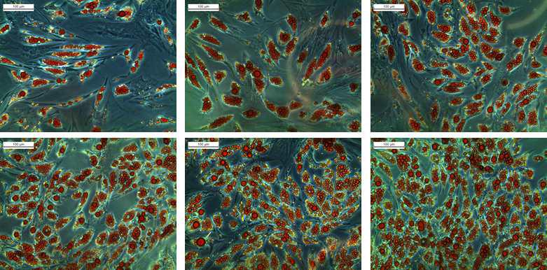 사람유래 지방줄기세포의 지방세포분화 염색법 Validation을 위한 Oil Red O 염색결과. 1250 cell/well (top left), 2500 cell/well (top center), 5000 cell/well (top right), 10000cell/well (bottom left), 20000 cell/well (bottom center), 40000 cell/well (bottom right)