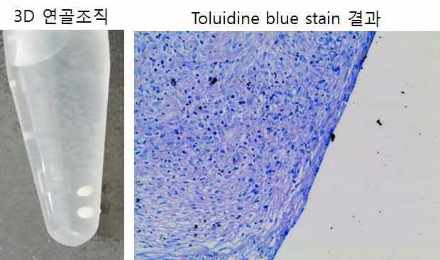 사람유래 지방줄기세포의 연골세포분화 결과.3D culture를 이용한 연골조직생성(left), 조직 단편 Toluidine blue염색 결과(right)