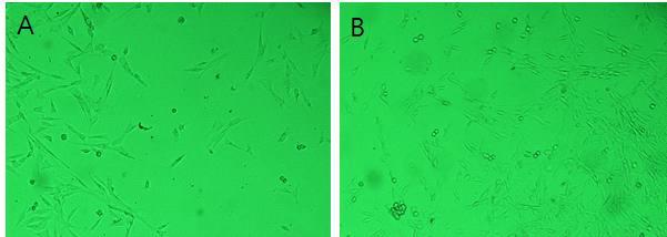 검역견 대니 유래로 DMEM 배양액을 사용한 섬유아세포