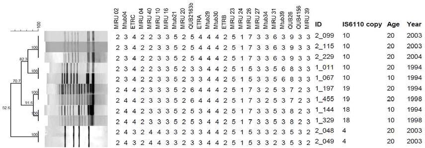 10-29세 연령대에서 분리한 5개의 IS6110-RFLP 및 MIRU-VNTR cluster